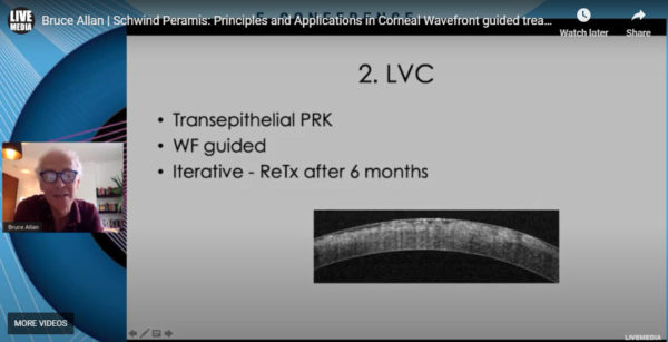 Bruce Allan MD, FRCS - Schwind Peramis: Principles and Applications in Corneal Wavefront guided treatments