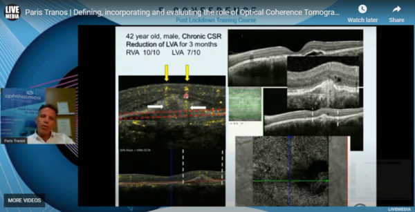 Πάρης Τρανός PhD, FRCS - Defining, incorporating and evaluating the role of Optical Coherence Tomography Angiography in clinical practice: The pros and cons of OCTA multimodal imaging toolbox in retinal pathology monitoring