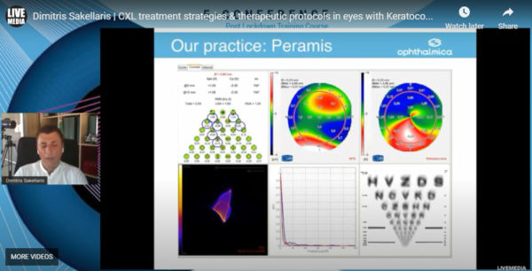 Δημήτρης Σακελλάρης MD - CXL treatment strategies & therapeutic protocols in eyes with Keratoconus: Which protocol to use when? (epi ON, epi OFF, pulsed, accelerated, traditional 9mm, CCXL, KXL, PRK combined, PTK combined)