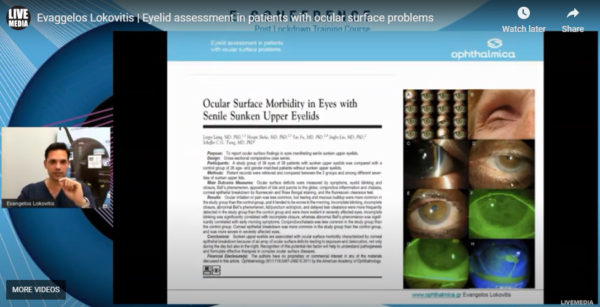 Ευάγγελος Λοκοβίτης MD, FEBOphth - Eyelid assessment in patients with ocular surface problems