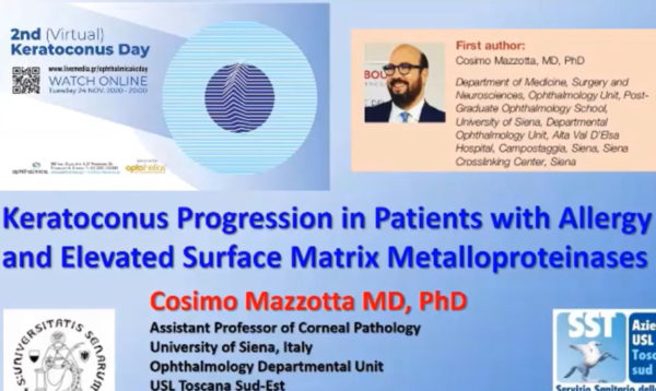 Cosimo Mazzotta MD, PhD, USL - Keratoconus progression in patients with allergy and elevated surface matrix Metalloproteinase 9