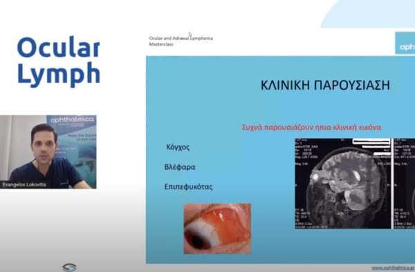 Evangelos Lokovitis MD, FEBOphth | Ocular & Adnexal Lymphoma Masterclass (Virtual)