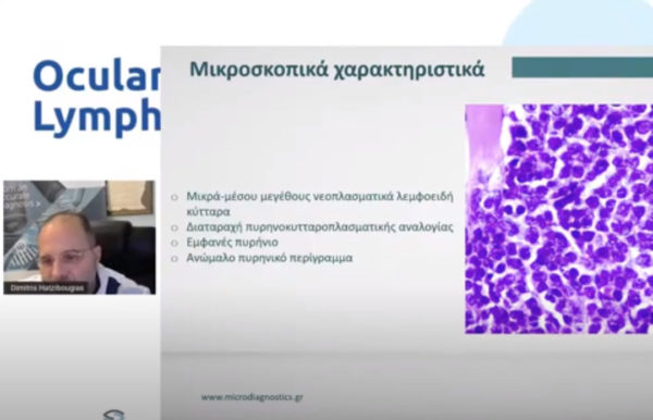 Dimitrios Hatzibougias MD, PhD, MSc | Ocular & Adnexal Lymphoma Masterclass (Virtual)