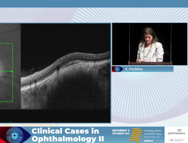 Management of suspicious choroidal lesions | Clinical Cases II | Έφη Παυλίδου MD, MSc