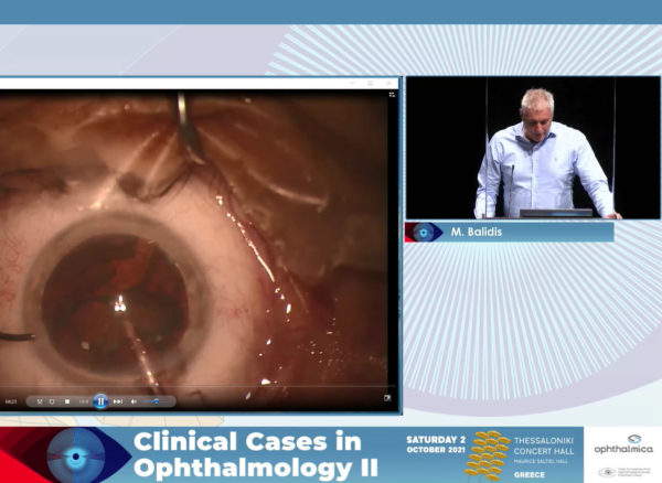 Phaco surgery: when to expect the unexpected | Clinical Cases II | Μίλτος Μπαλίδης PhD, FEBOphth, ICOphth