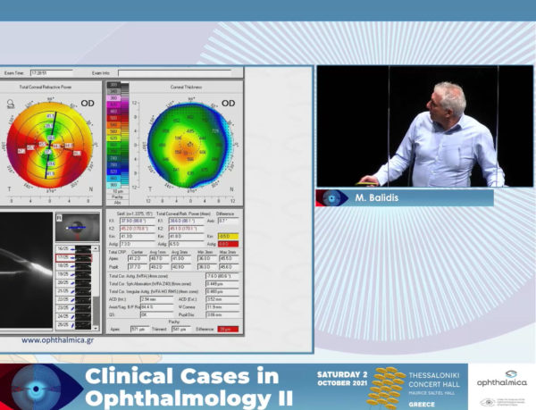 Modern IOL calculation: when biometry meets topography | Clinical Cases II | Μίλτος Μπαλίδης PhD, FEBOphth, ICOphth