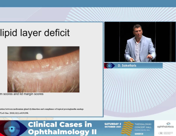 Diagnostic approach in dry eye disease | Clinical Cases II | Δημήτριος Σακελλάρης MD