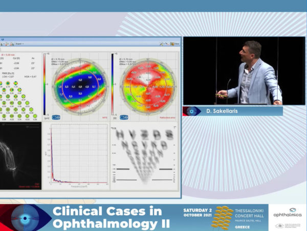 Corneal wavefront: when wavefront meets topography | Clinical Cases II | Δημήτριος Σακελλάρης MD