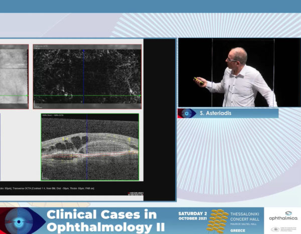 Degenerative retinal diseases: Survival guide when all look the same | Clinical Cases II | Σόλων Αστεριάδης MD, FRCS