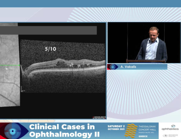 Update on vascular retinal disease: Application in clinical practice | Clinical Cases II | Θάνος Βακάλης MD