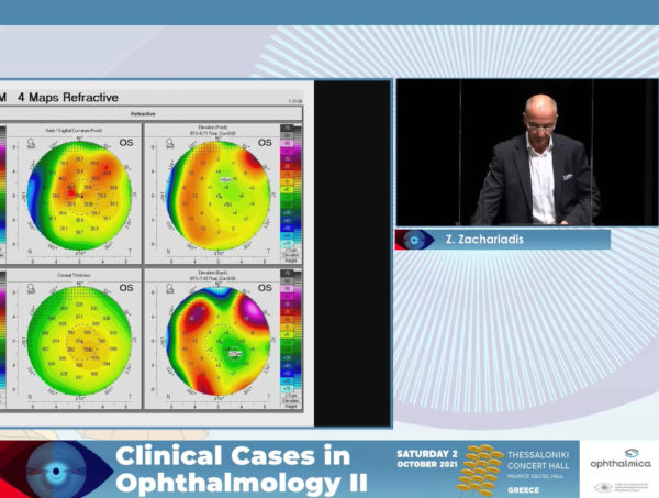 Corneal topography: when OCT meets topography | Clinical Cases II | Ζάχος Ζαχαριάδης MD, DO