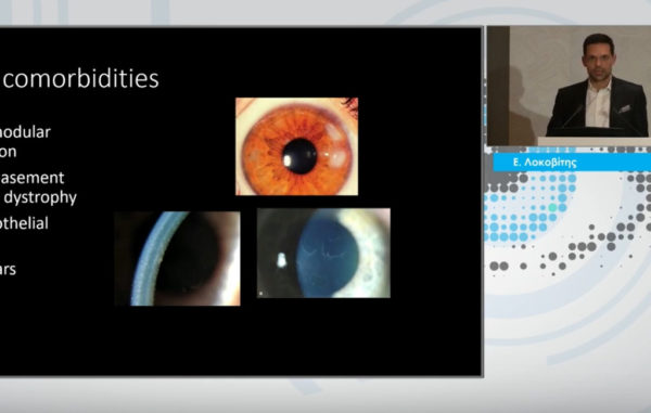 Premium IOL Technology: Pre-operative Assessment and Management | New Technologies in Ophthalmology | Ευάγγελος Λοκοβίτης MD, FEBOphth