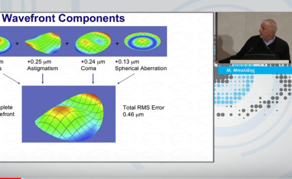 EDOF IOL New Kids on the Block: Experience and Surgical Outcomes with X-EDOF Technology | New Technologies in Ophthalmology | Μίλτος Μπαλίδης PhD, FEBOphth, ICOphth