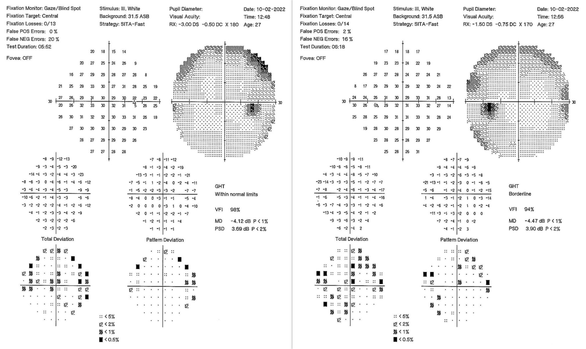 Case of the month (Feb 2022) Οφθαλμολογικό Κέντρο Ophthalmica