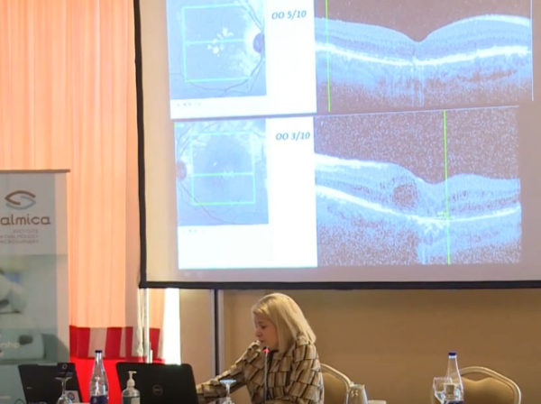 Επιστημονική συνάντηση στην Καστοριά | Θεματική ενότητα: Medical Retina & Uveitis | Χρύσα Κουτσιούκη MD