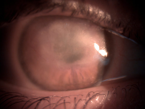 Case of the month (May 2022)
