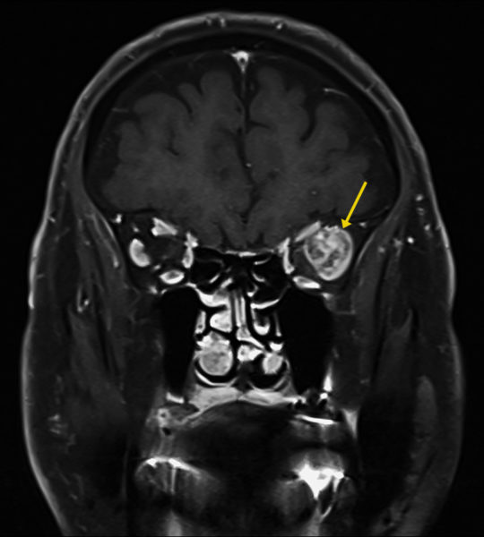 Case of the month (Dec 2022)