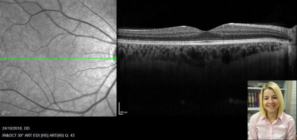 Το Ινστιτούτο Ophthalmica στο μαθήματα του Μεταπτυχιακού Προγράμματος Σπουδών «Σύγχρονες Προσεγγίσεις στην Παθολογία και Χειρουργική του Αμφιβληστροειδούς»