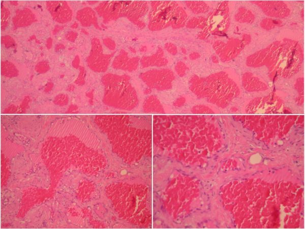 Case of the month (Oct 2023)
