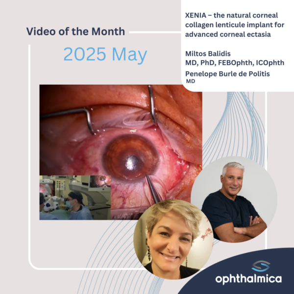 Video of the month | March 2025 | XENIA – the natural corneal collagen lenticule implant for advanced corneal ectasia