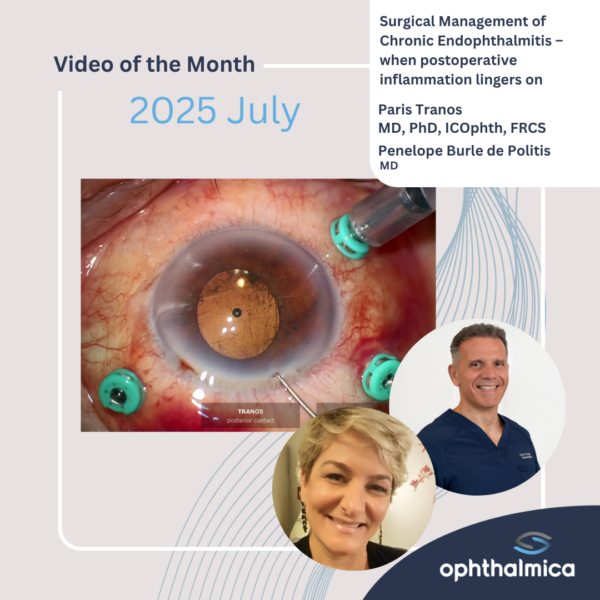 Video of the month | July 2025 | Surgical Management of Chronic Endophthalmitis – when postoperative inflammation lingers on