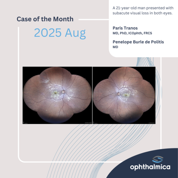 Case of the month | Aug 2025 | A 21-year-old man presented with subacute visual loss in both eyes