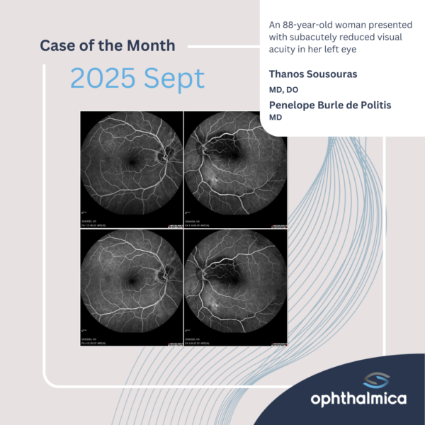 Case of the month | Sept 2025 | An 88-year-old woman presented with subacutely reduced visual acuity in her left eye
