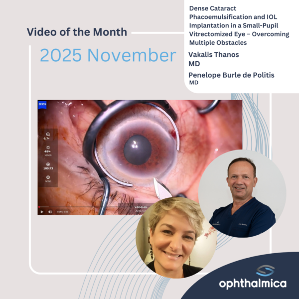 Video of the month | November 2025 | Dense Cataract Phacoemulsification and IOL Implantation in a Small-Pupil Vitrectomized Eye – Overcoming Multiple Obstacles