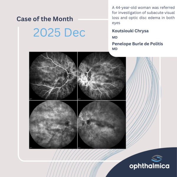 Case of the month | Dec 2025 | A 44-year-old woman was referred for investigation of subacute visual loss and optic disc edema in both eyes