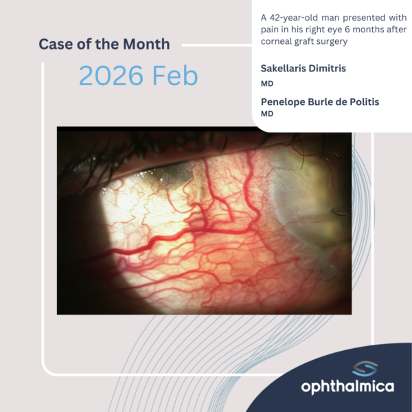 Case of the month | Feb 2026 | A 42-year-old man presented with pain in his right eye 6 months after corneal graft surgery