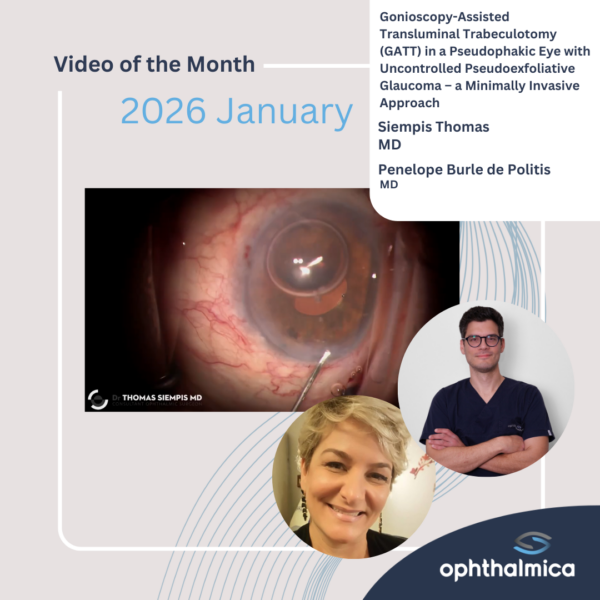 Video of the month | January 2026 | Gonioscopy-Assisted Transluminal Trabeculotomy (GATT) in a Pseudophakic Eye with Uncontrolled Pseudoexfoliative Glaucoma – a Minimally Invasive Approach